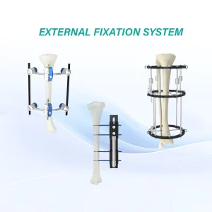 Orthopedic stainless synthes external fixation fixator