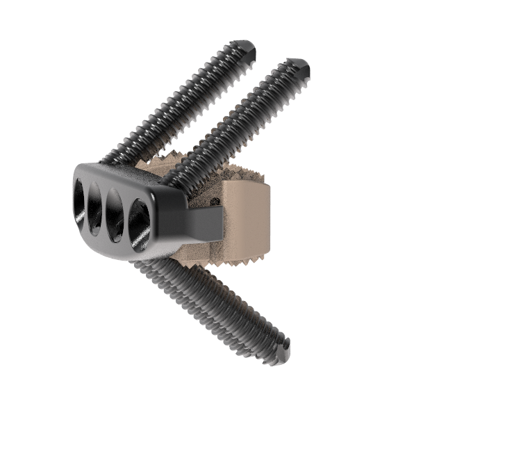 Buy ZP Cervical Cage Manufacturer CE FSC ISO Insured Supplier Exporter, Company