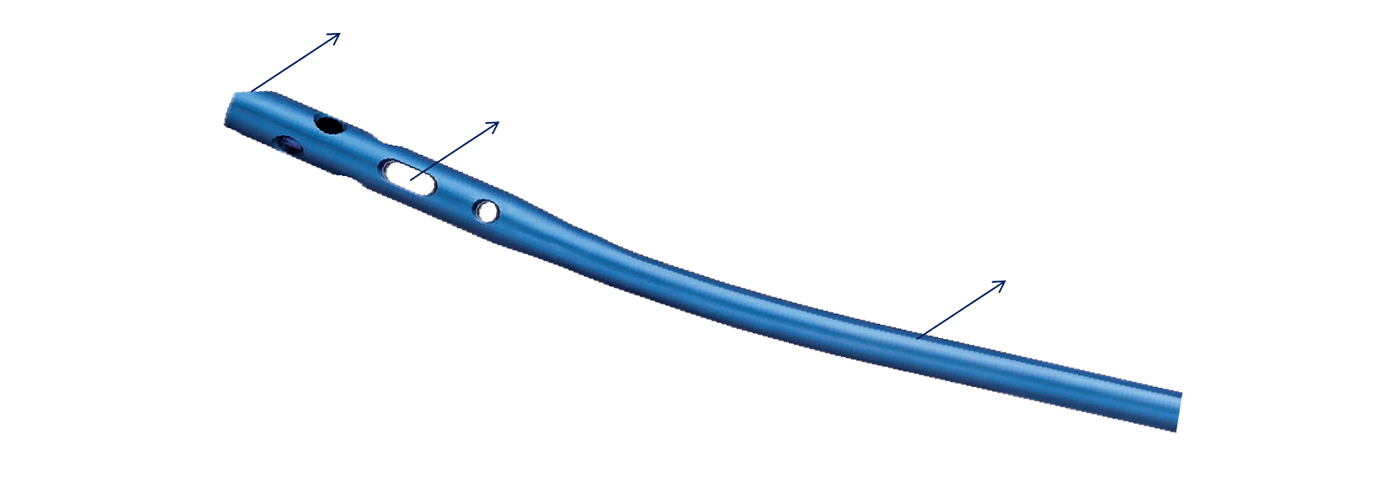 MASTIN End Cap Features