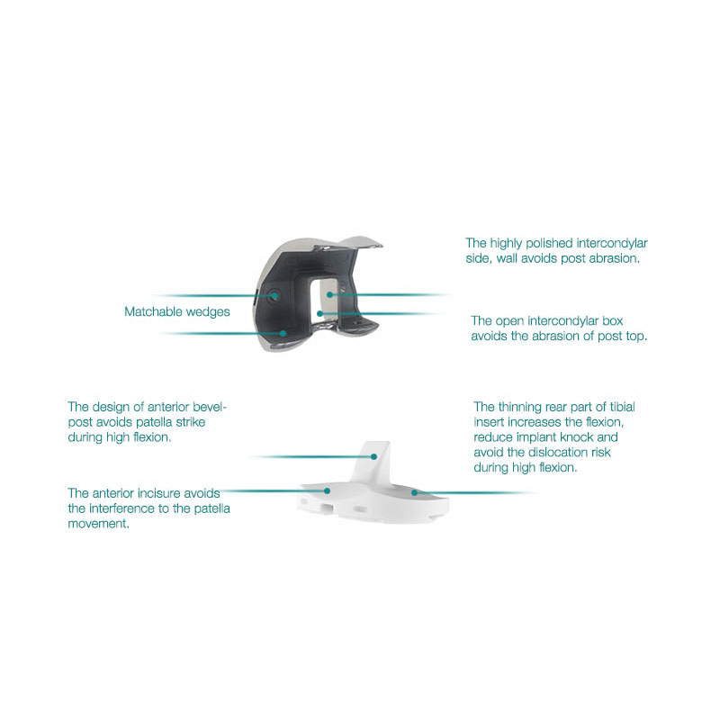 Buy High Quality Titanium Total Knee Joint Replacement Implants  Pricelist, Companies
