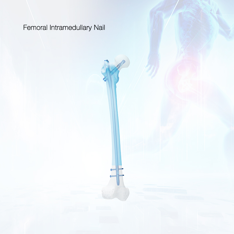 Cheap Surgical Orthopedic Implant Titanium ZAFIN Intramedullary Nail Pricelist, Exporters