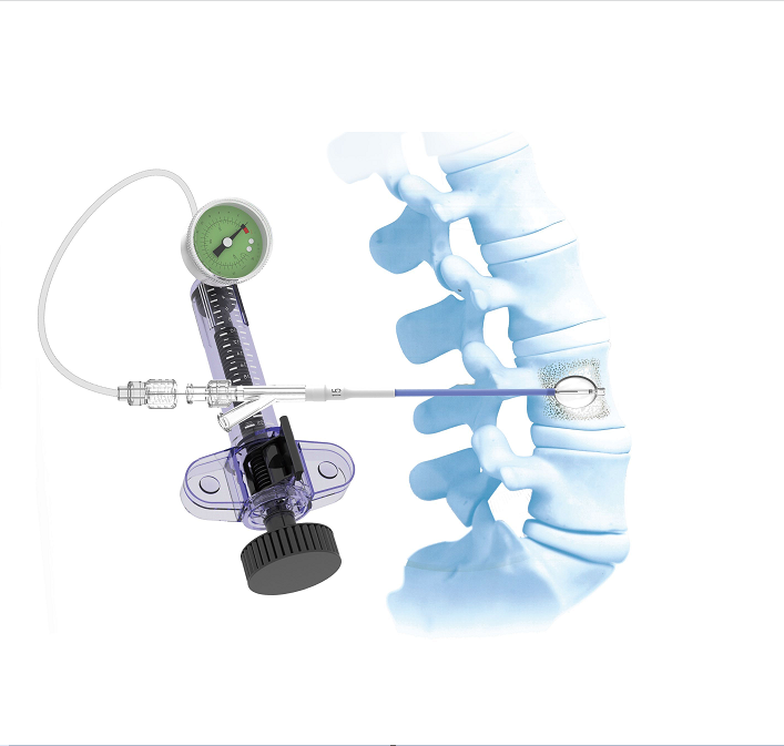 Famous Professional manufacturer PKP layer Vertebroplasty instruments set kit  Exporters, Products