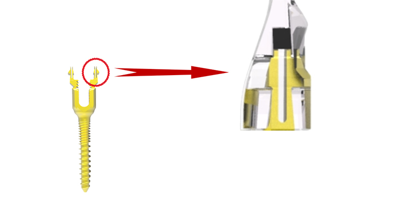 Lateral and medial locking mechanism