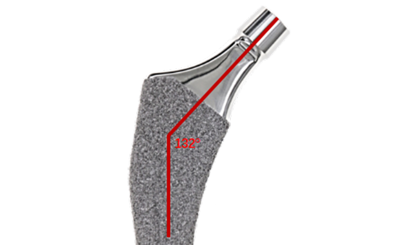 Curved Distal End