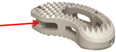 Connection cylinder interface