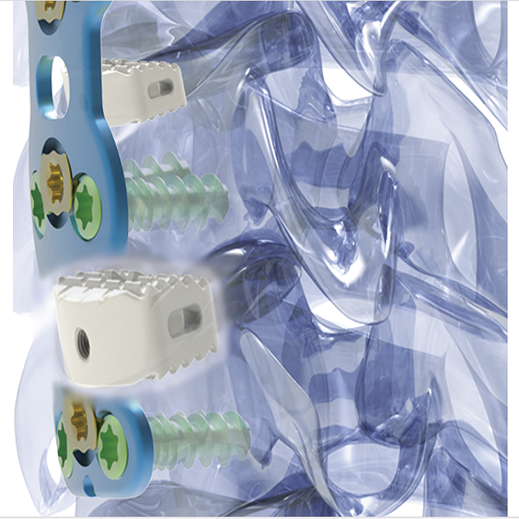 Discount ZATH Brand Cervical Interbody Cage PEEK Cage Factory CE ISO Pricelist, Quotes
