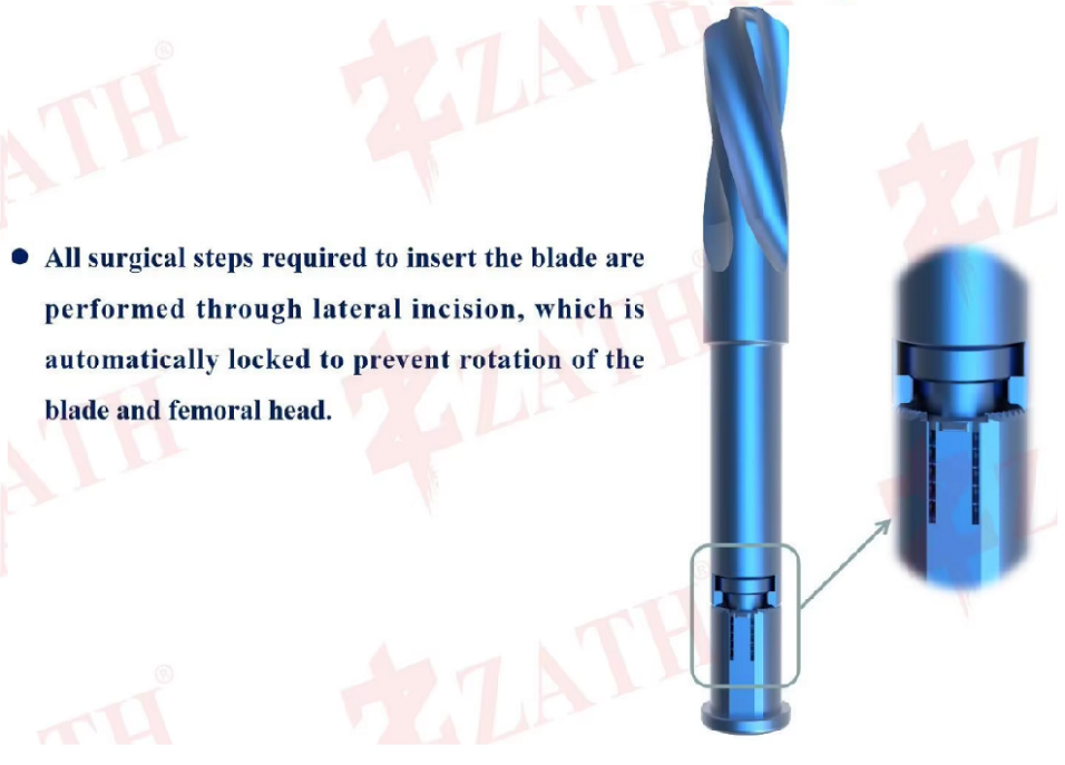 ZAFIN Interlocking Mechanism Details