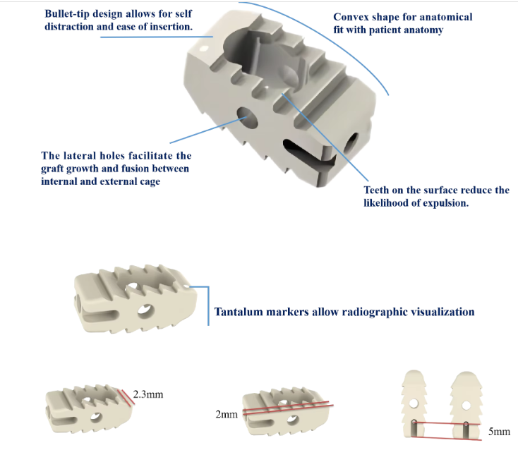 Famous Thoracolumbar Interbody Cage (Straight) Manufacturers, Factories