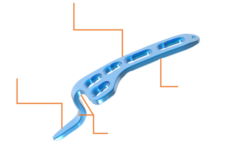 Posterior Hook Offset Configuration