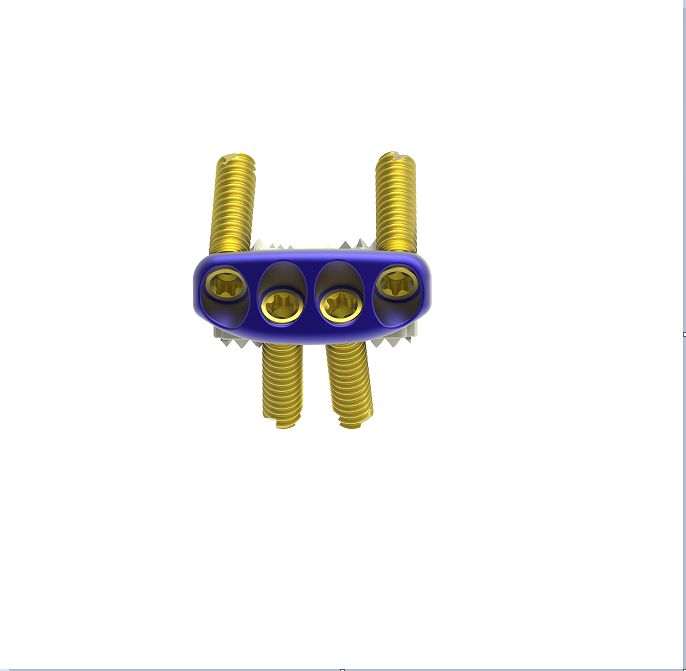 Buy ZP Cervical Cage Manufacturer CE FSC ISO Insured Supplier Exporter, Company