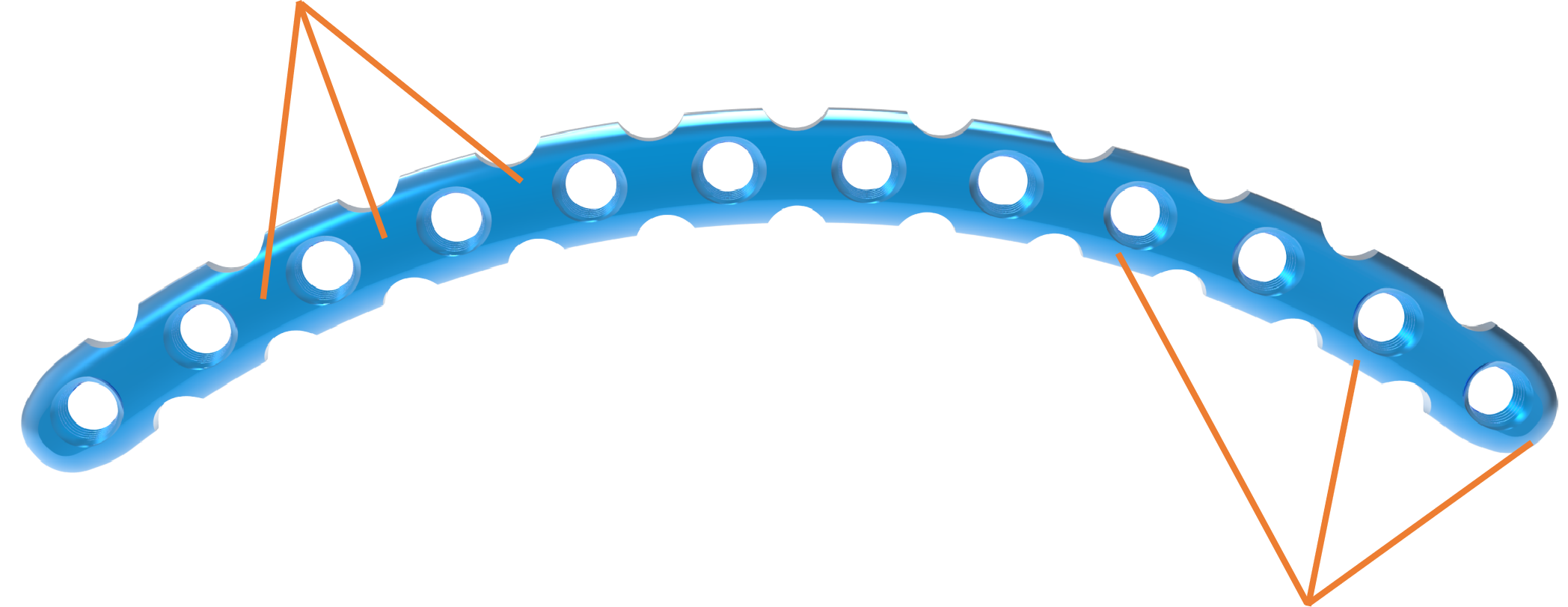 Curved Reconstruction Locking Plate Overview