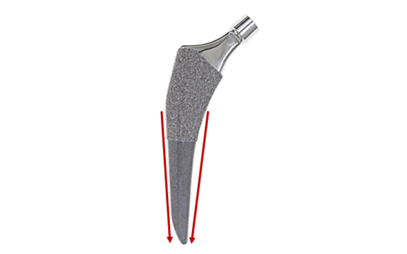 Reduced Lateral Shoulder