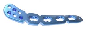 Distal Clavicle Locking Compression Plate