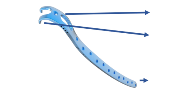 Proximal Femur Fixation Details
