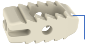 Bullet-tip design