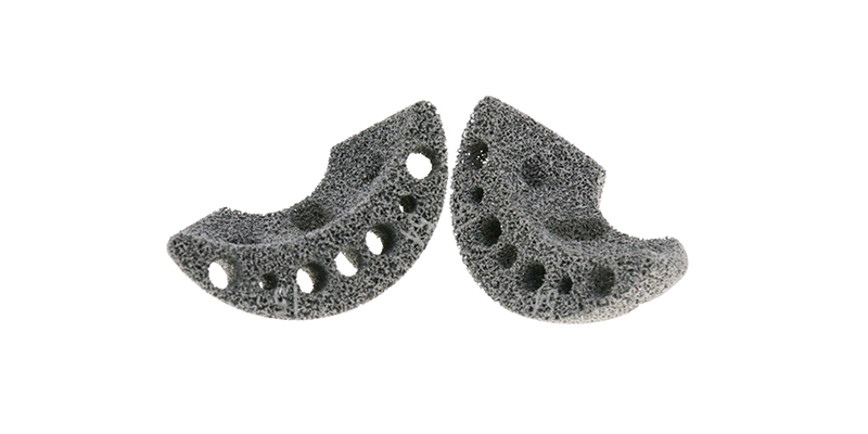 Optimized Geometry and Trabecular Structure