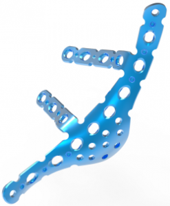 Winged Pelvis Reconstruction Locking Compression Plate
