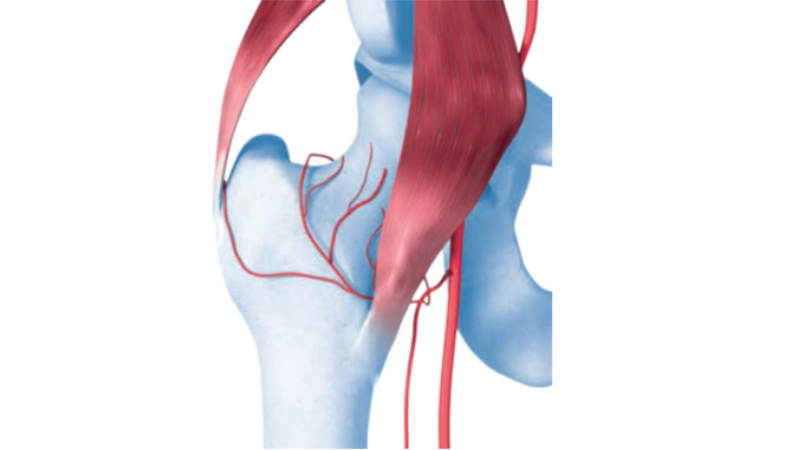 Lateral Entry Point