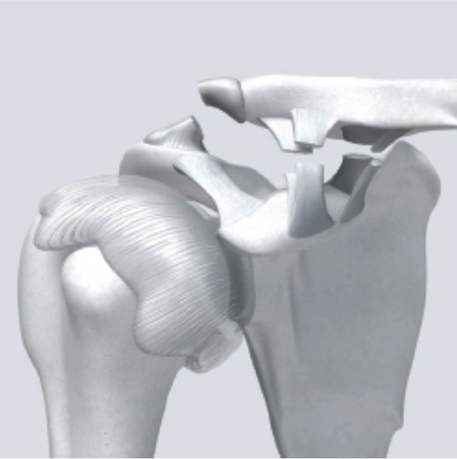 Implant Smooth Hook Structure