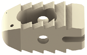 Thoracolumbar Interbody Cage Straight
