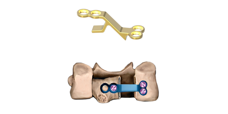 Dome Open Door Plate