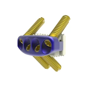 Buy ZP Cervical Cage Manufacturer CE FSC ISO Insured Supplier Exporter, Company