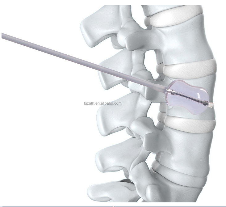 Famous Professional manufacturer PKP layer Vertebroplasty instruments set kit  Exporters, Products