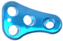 Proximal Femur MIS Locking Plate II