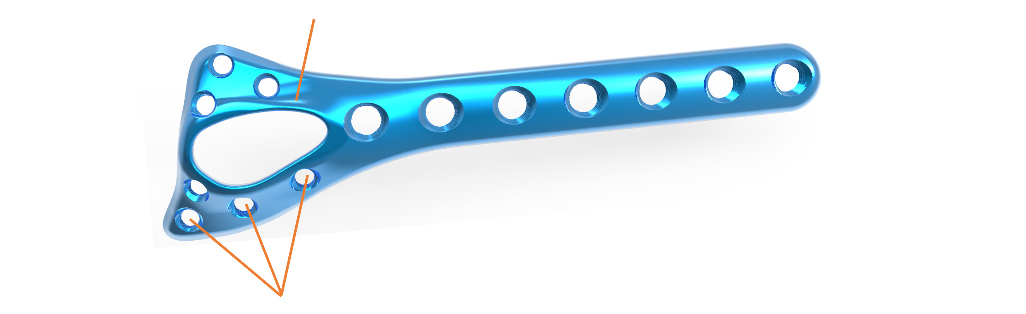 DDR Locking Compression Plate Design and Application