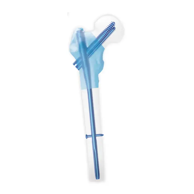InterZan titanium femoral interlocking intramedullary nail