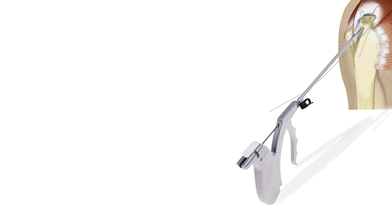 SuperFix Suture Passer - Simplistic and ergonomic design