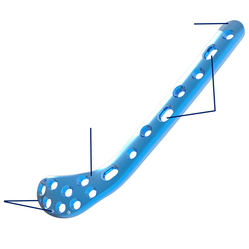 Distal Medial Femur Plate Overview