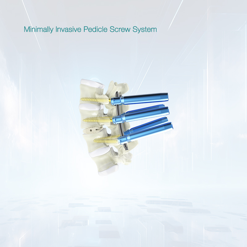 OEM High Quality ZATH HE Minimal Invasive Spine Pedicle Screw Manufacturers, Exporters
