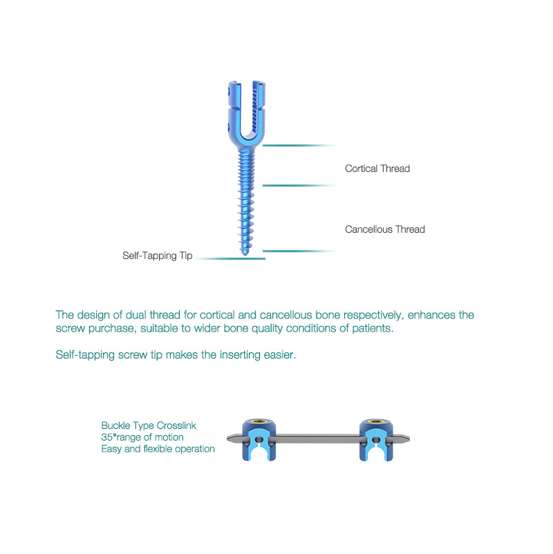 OEM CE approved Zipper Polyaxial Pedicle Screws Spine System Manufacturer, Product