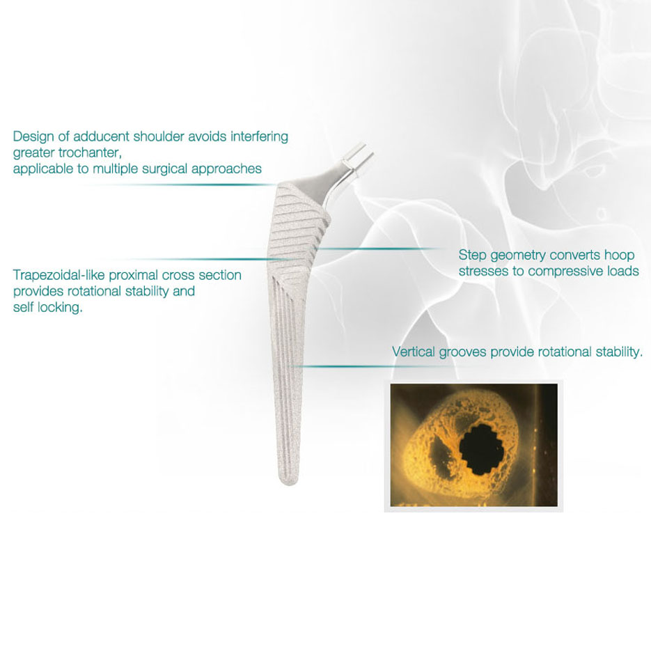 Discount Professional Medical Hip Implant Titanium Bipolar Hip Joint Prosthesis  Manufacturers, Supplier