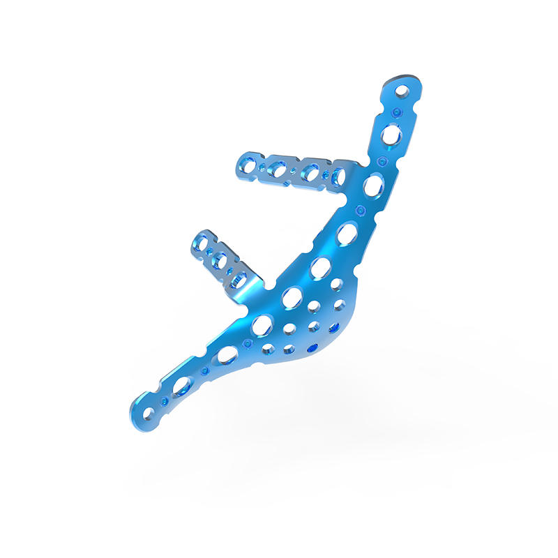 Custom Winged Pelvis Reconstruction Locking Compression Plate Factories, Exporter