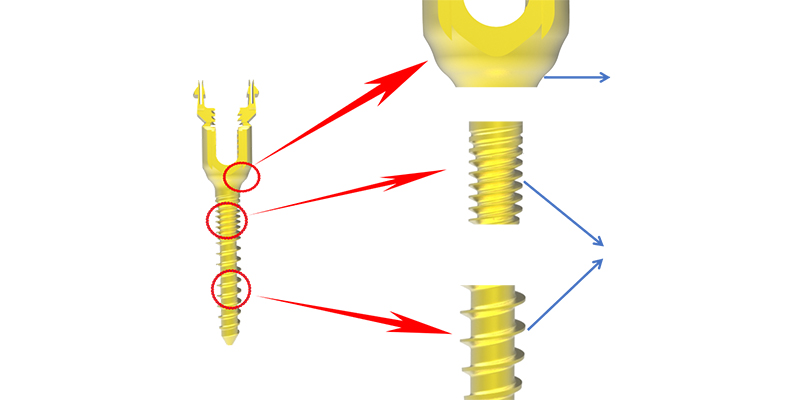 Breakable Setscrew comparison