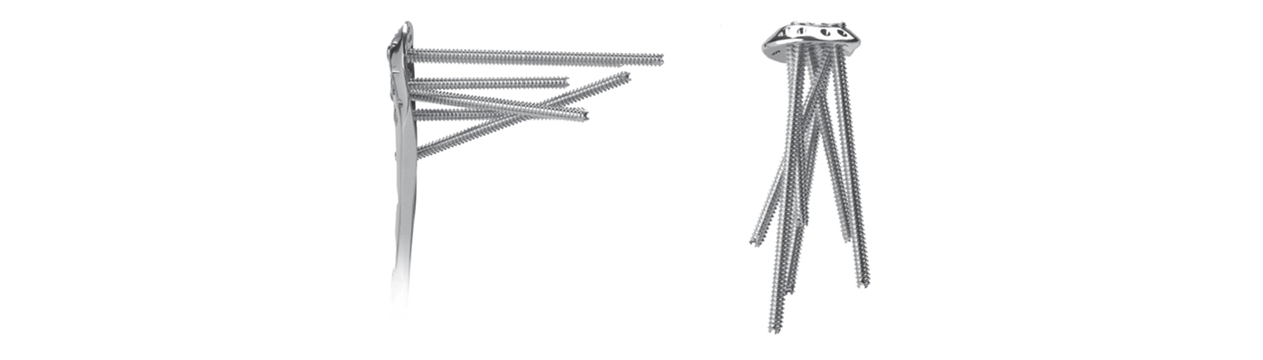Optimal screw trajectories