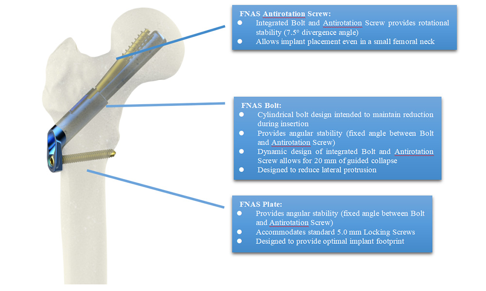 FNAS Plate Feature