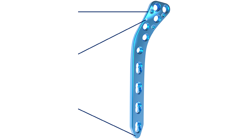 OEM Proximal Lateral Tibia Locking Compression Plate Supplier, Factories
