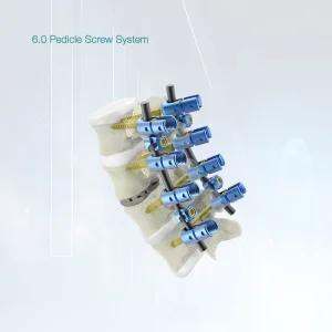 OEM CE approved Zipper Polyaxial Pedicle Screws Spine System Manufacturer, Product