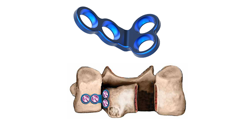 Dome Hinge Plate