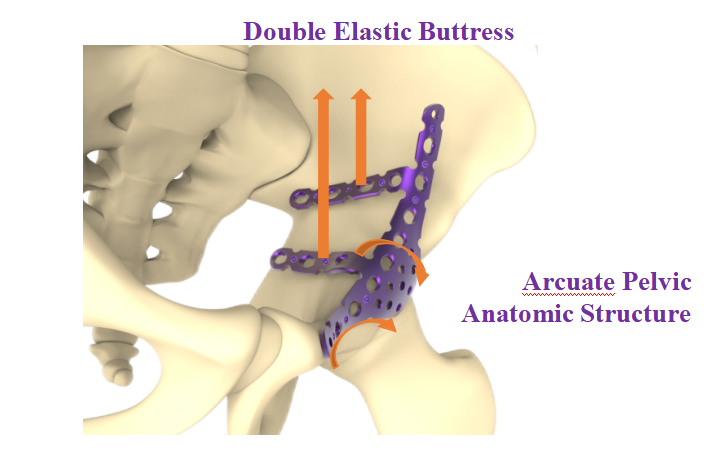 Custom Winged Pelvis Reconstruction Locking Compression Plate Factories, Exporter