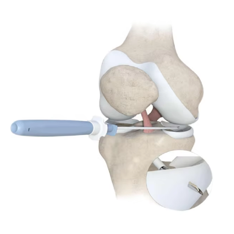 ODM Orthopedic Fast All Inside Meniscal Repair Device System  Products, Service