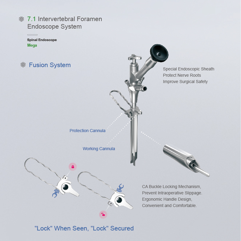 Wholesale 7.1mm Intervertebral Foramen Endoscope System Factory, Factories