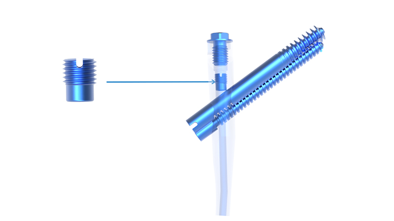 Surgical Construct
