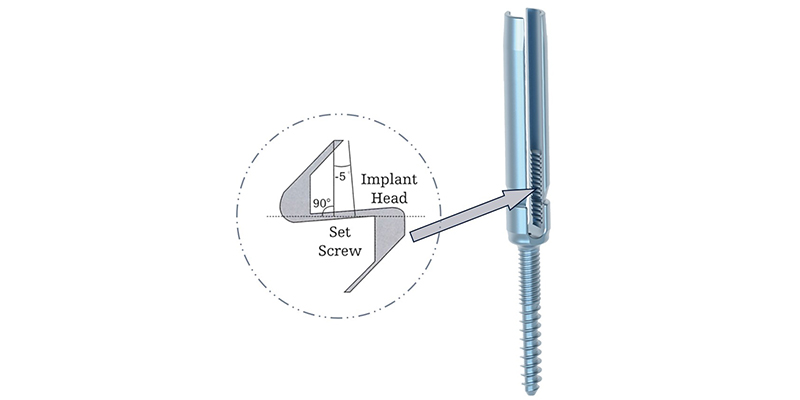 Minimally Invasive Pedicle Screw Instrumentation