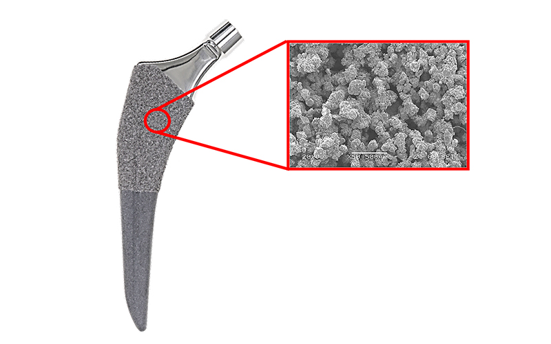 Distal ML Dimension