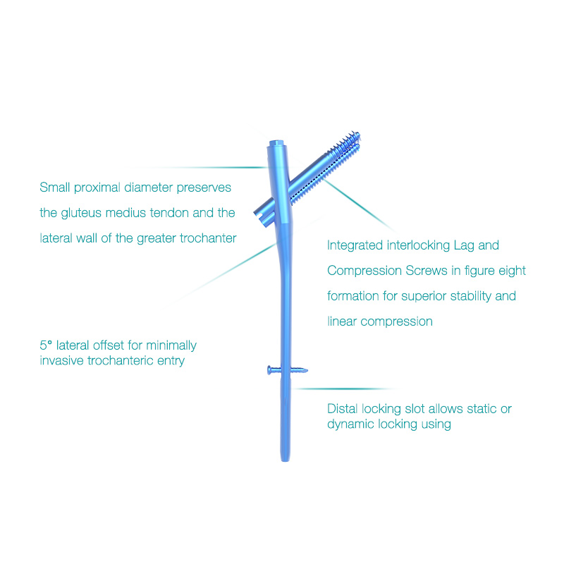 OEM Surgical Hospital Use InterZan Titanium Interlocking Nail for Femur Supplier, Factories