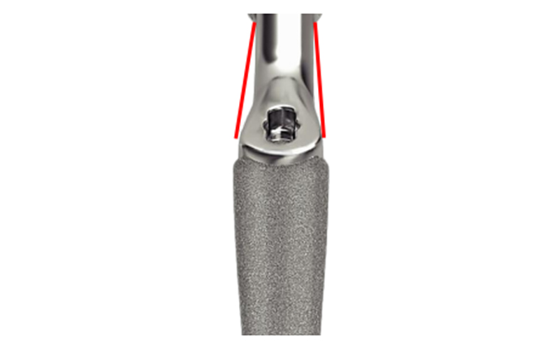 CDA and Osteotomy Angle Design